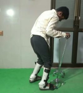 عقب زدگی زانو