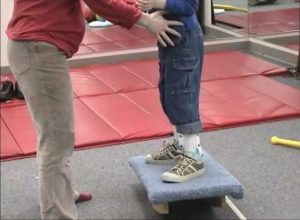 عقب زدگی زانو