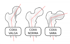 کوکسا والگا