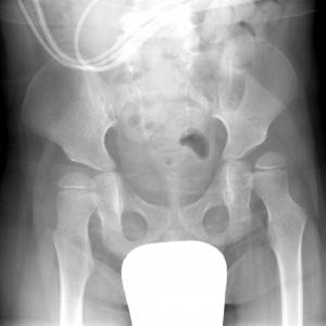 کوکسا والگا