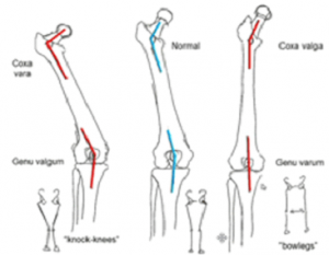کوکسا والگا