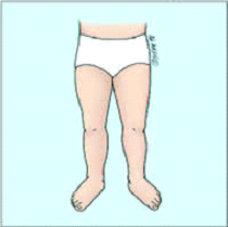 چرخش رو به خارج پا