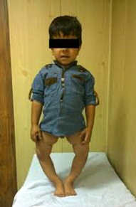 زانوی پرانتزی